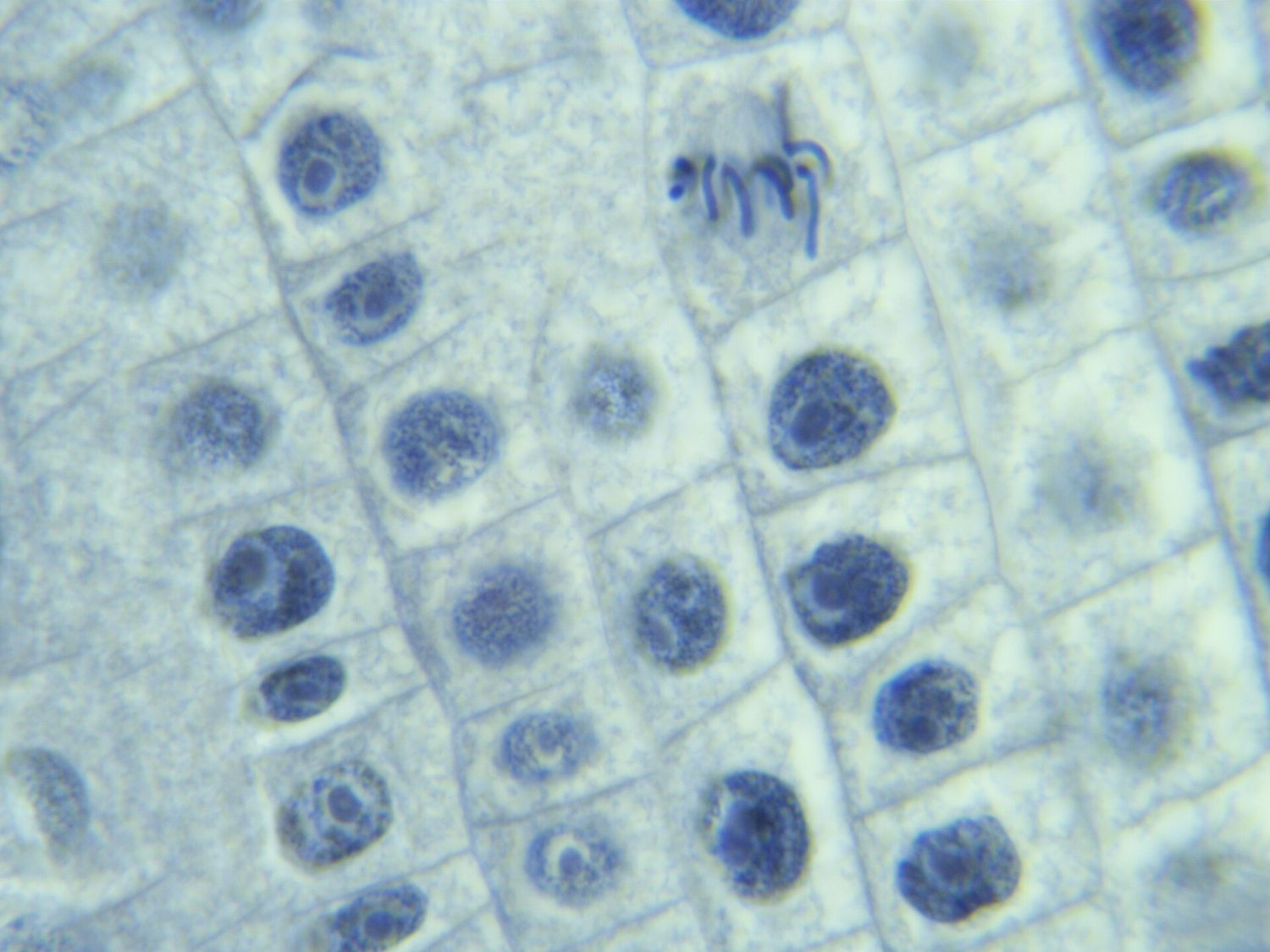 Onion root tip at metaphase: mitosis produces identical body cells for growth and repair