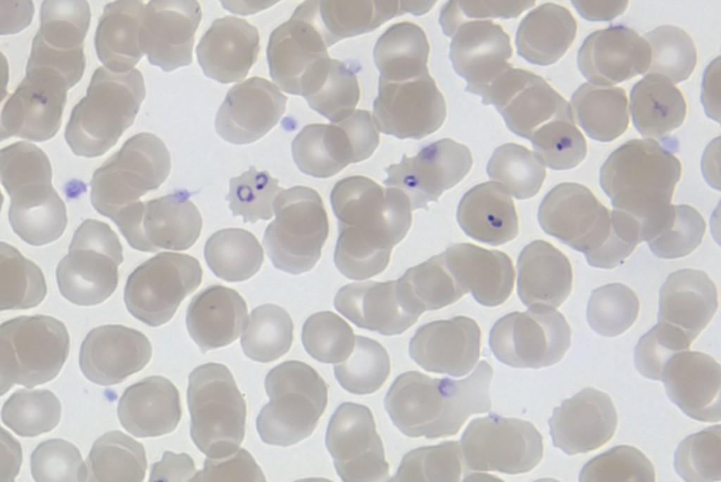 A blood smear showing many pale red blood cells, some containing small dark-stained Plasmodium parasites