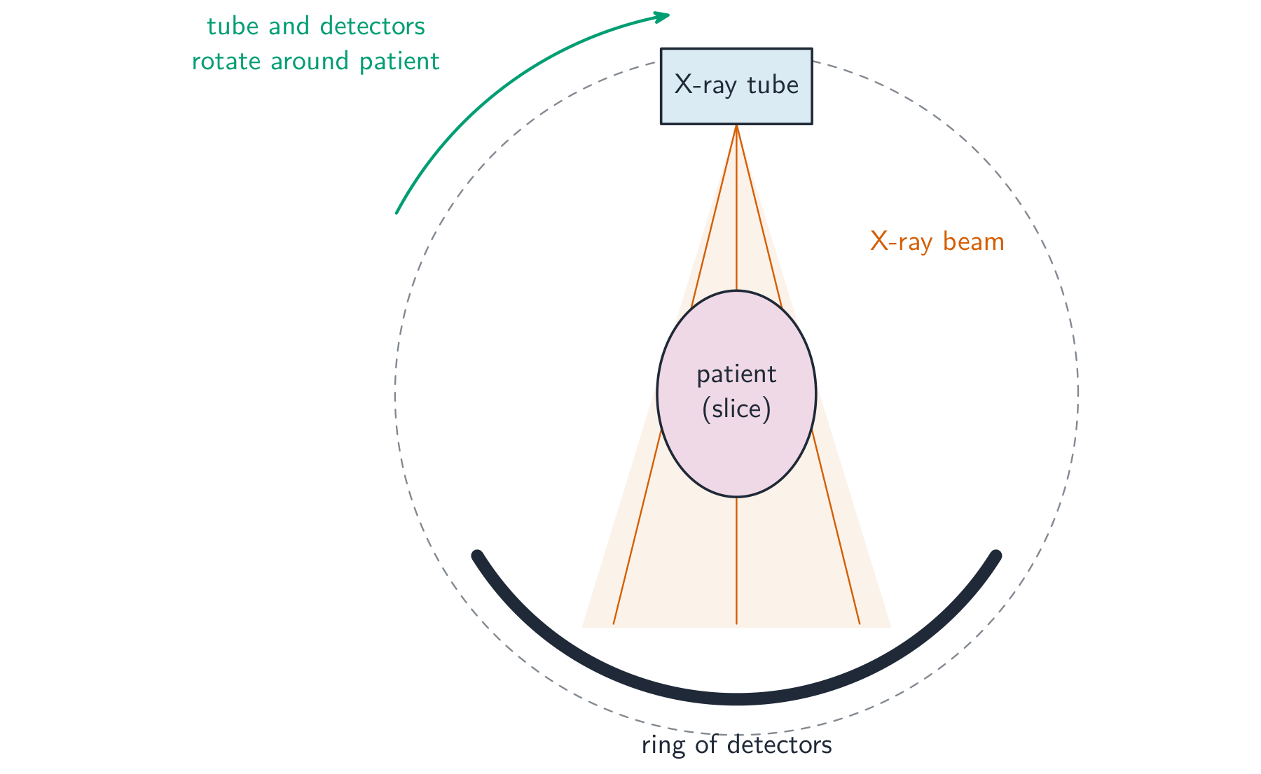 A CT-scan arrangement: a fan of X-ray beams passes through the patient's body to a curved array of X-ray detectors on the far side, and the tube and detectors rotate around the patient