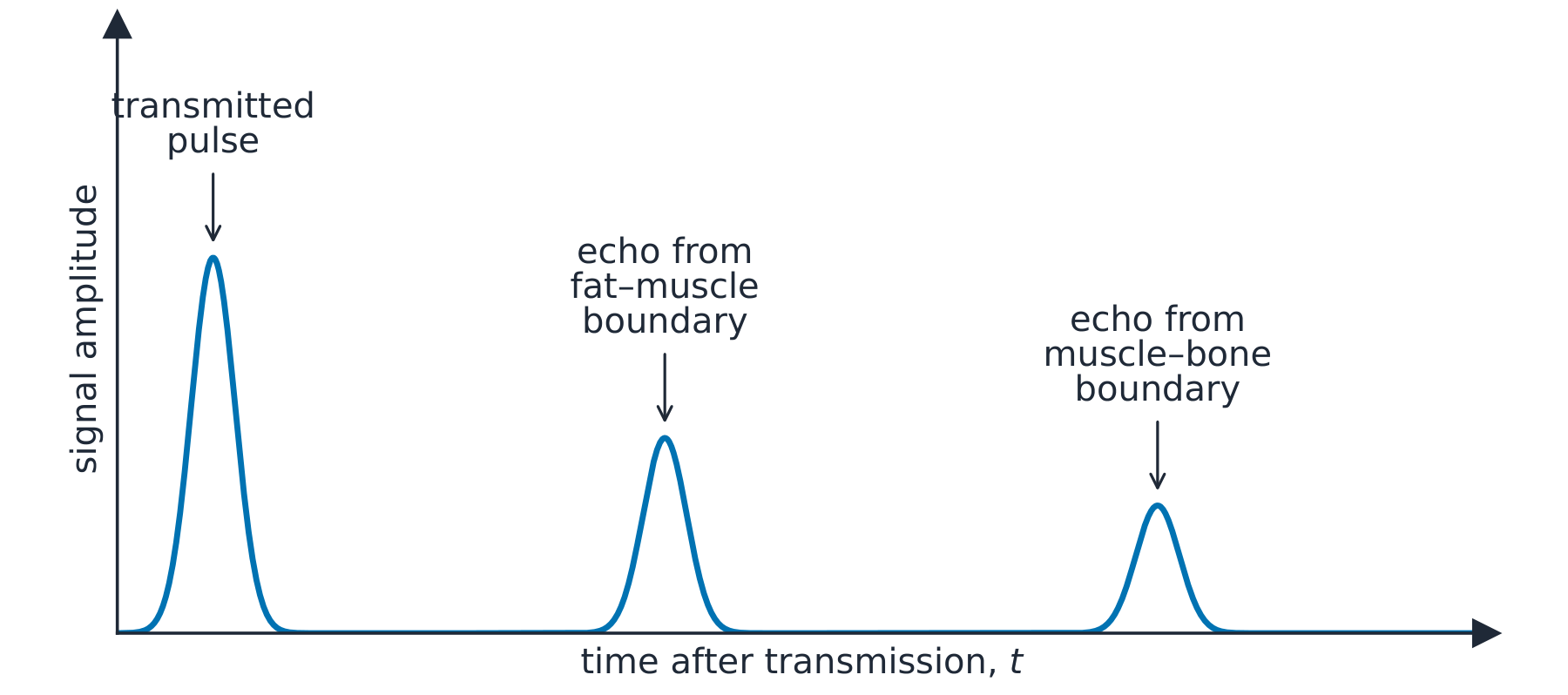 An A-scan trace on an oscilloscope: a large transmitted pulse, then smaller echo pulses from the fat–muscle boundary and the muscle–bone boundary at later times