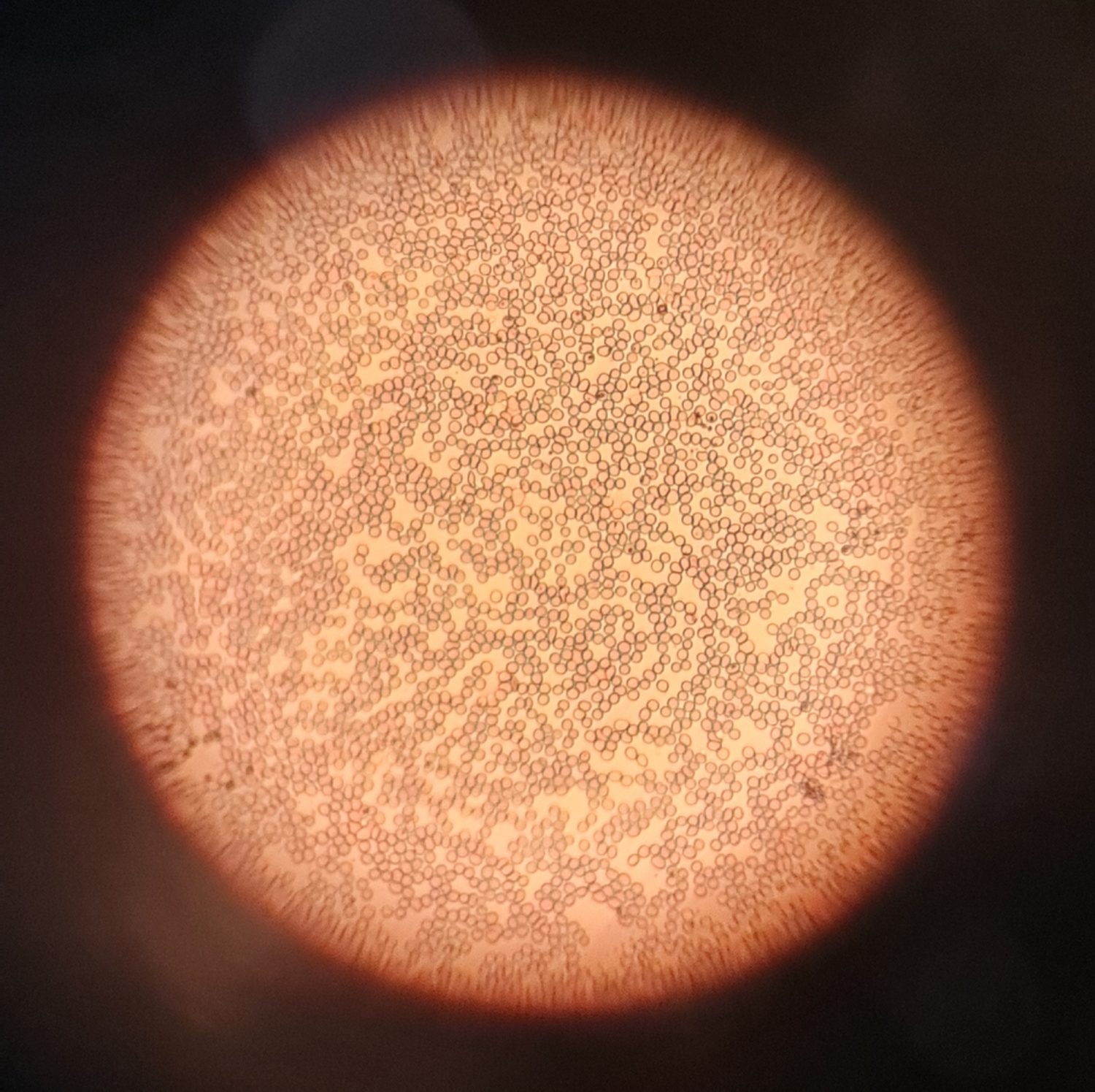 Red blood cells seen under a microscope
