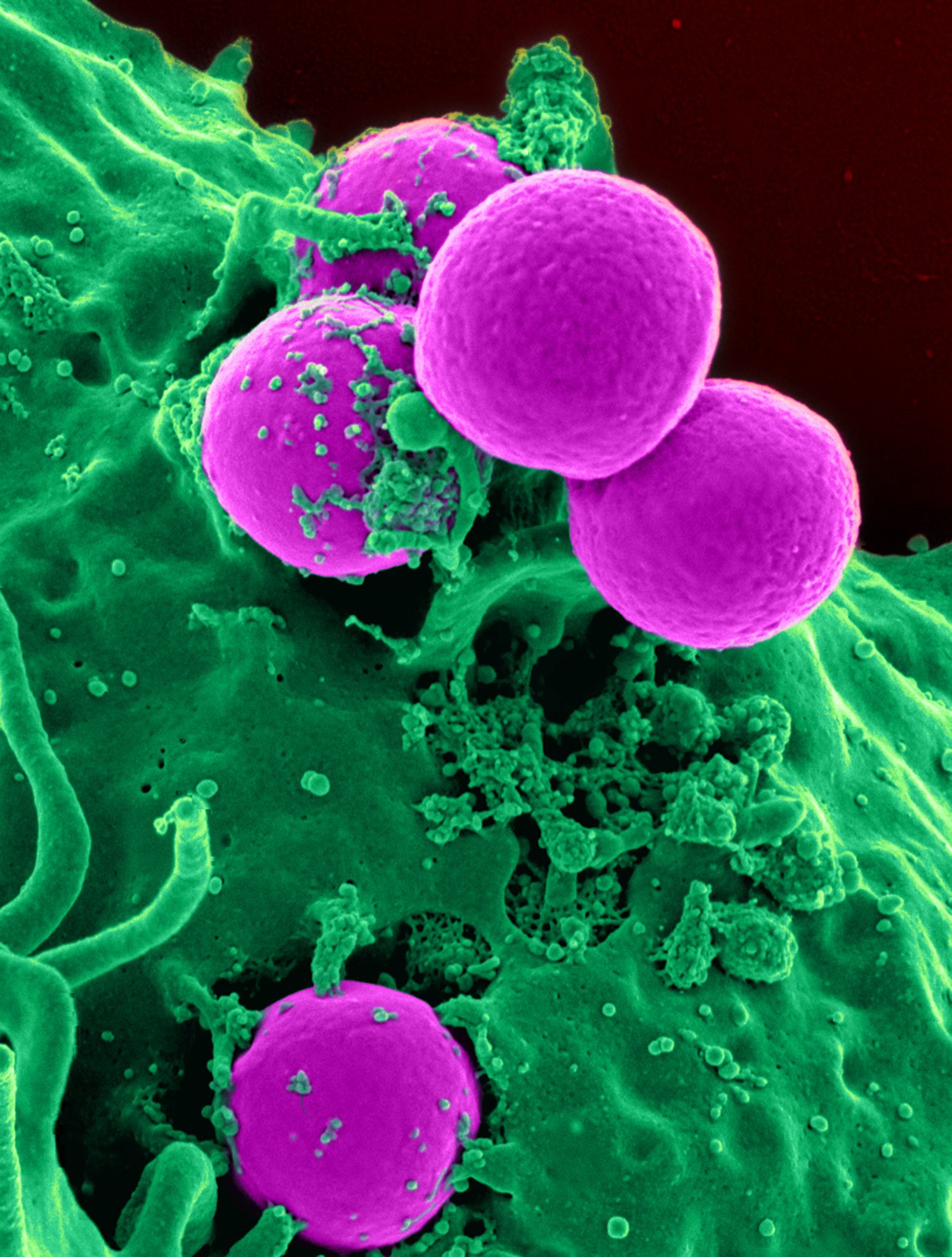 A false-coloured electron micrograph of a white blood cell, shown in green, wrapping around several round purple bacteria as it engulfs and destroys them
