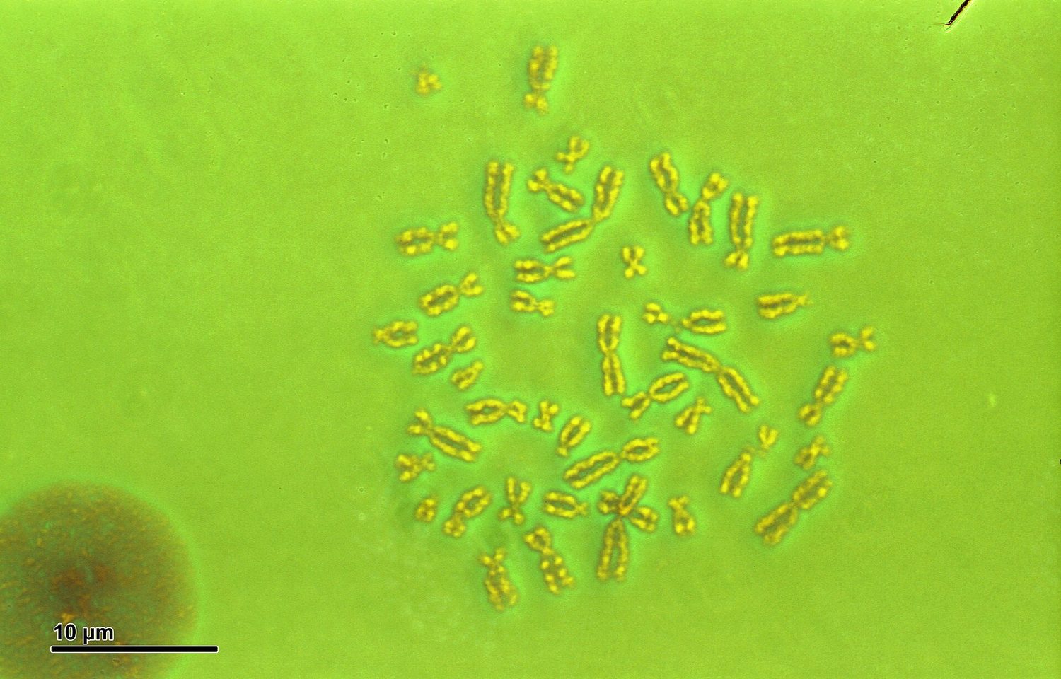 A human karyotype: chromosomes arranged in pairs