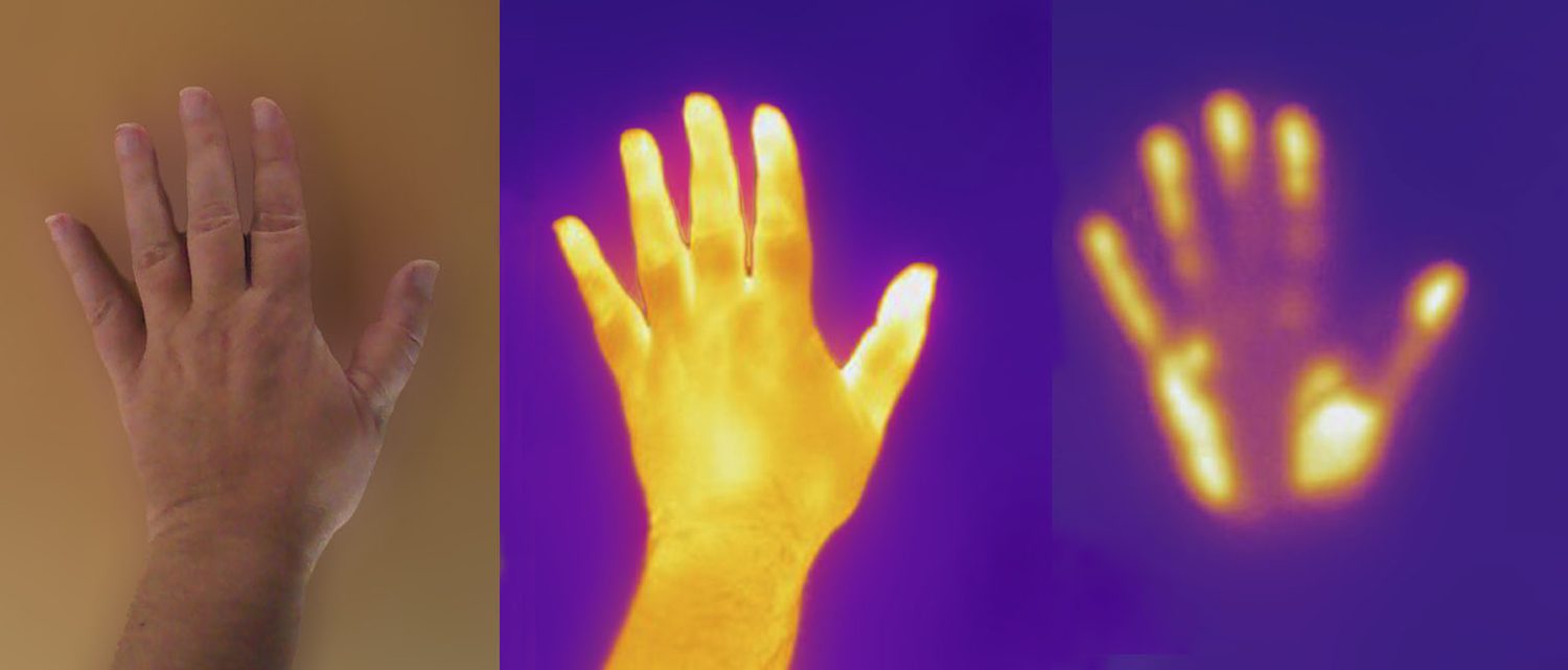 Three pictures of one hand: in ordinary light, then warm and glowing yellow in a thermal camera, then cooler and darker
